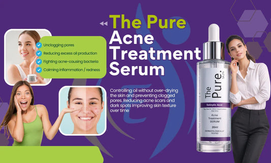 The Ultimate Guide to Skincare Serums for Acne-Prone Skin