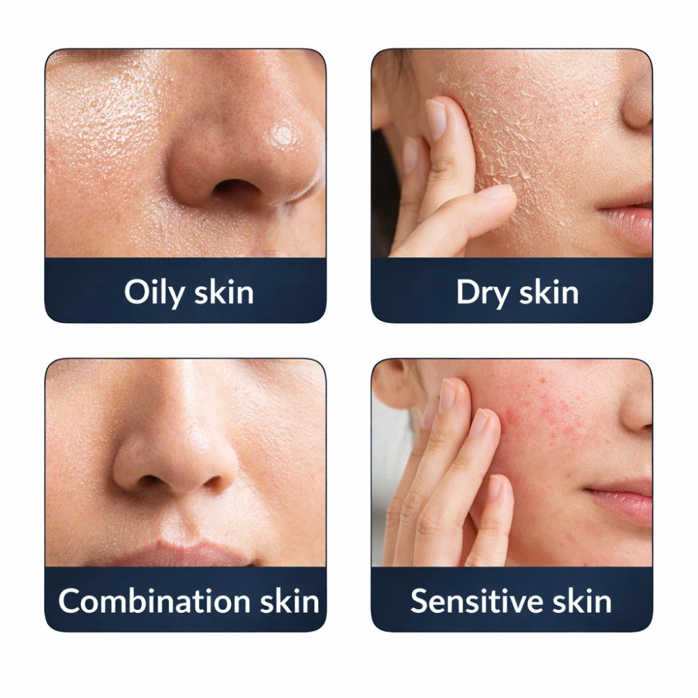 Four types of skin conditions on a person's face with labels for oily, dry, combination, and sensitive skin.